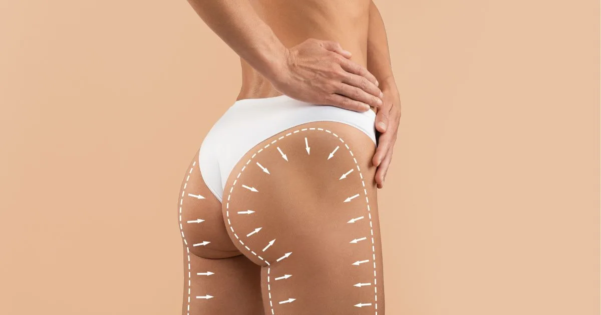 Non-Surgical Butt Lift area on a woman's body, showing arrows for contouring and lift, promoting a sculpted shape in Austin, TX